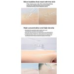 Carenel Niacinamide Zinc Serum - Image 2