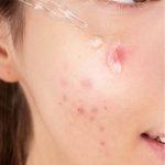 Carenel Niacinamide Zinc Serum - Image 5